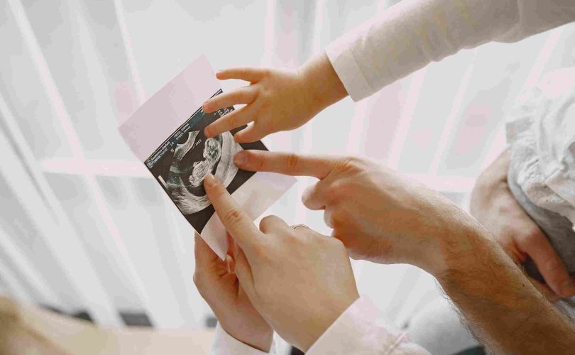 ما العلاقة بين القلق ومضاعفات الولادة؟